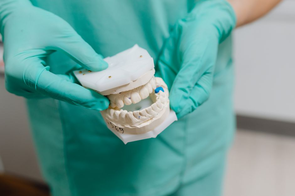 A dentist in gloves holds a detailed dental cast, showcasing dental care precision.