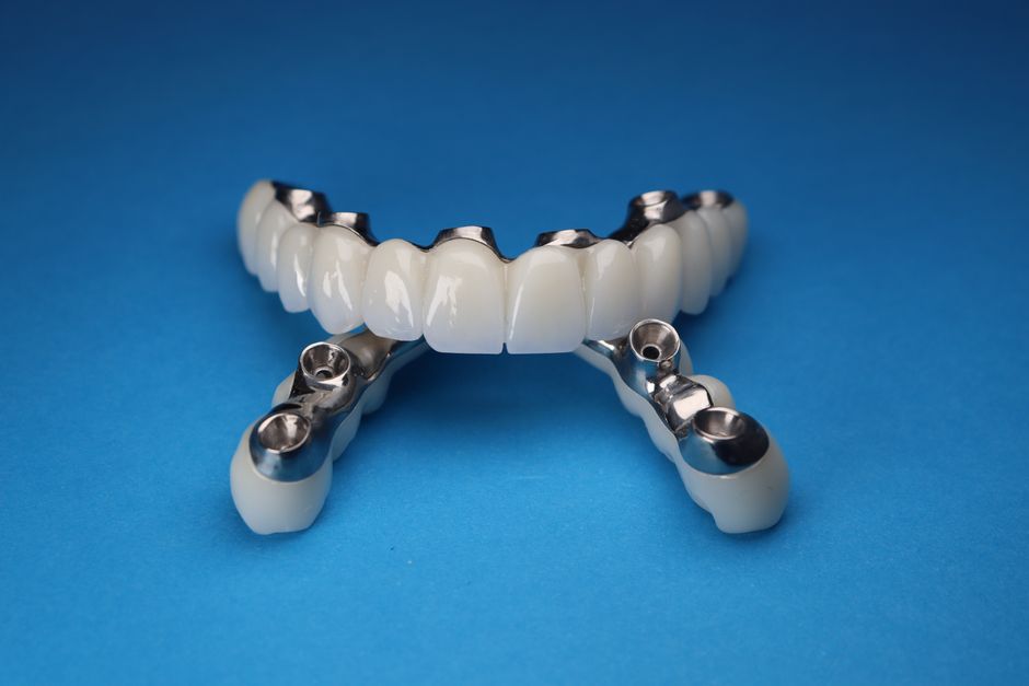 Close-up of dental implant prosthetics on a vivid blue background, showcasing precision and dental technology.