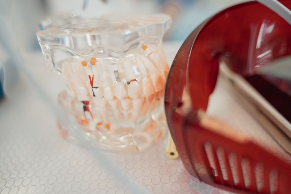 A dental model and red protective glasses on a textured surface, highlighting dental health tools.