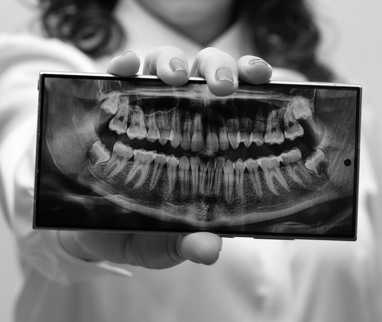 A detailed dental X-ray being held by a dentist in a clinic setting, illustrating teeth alignment.