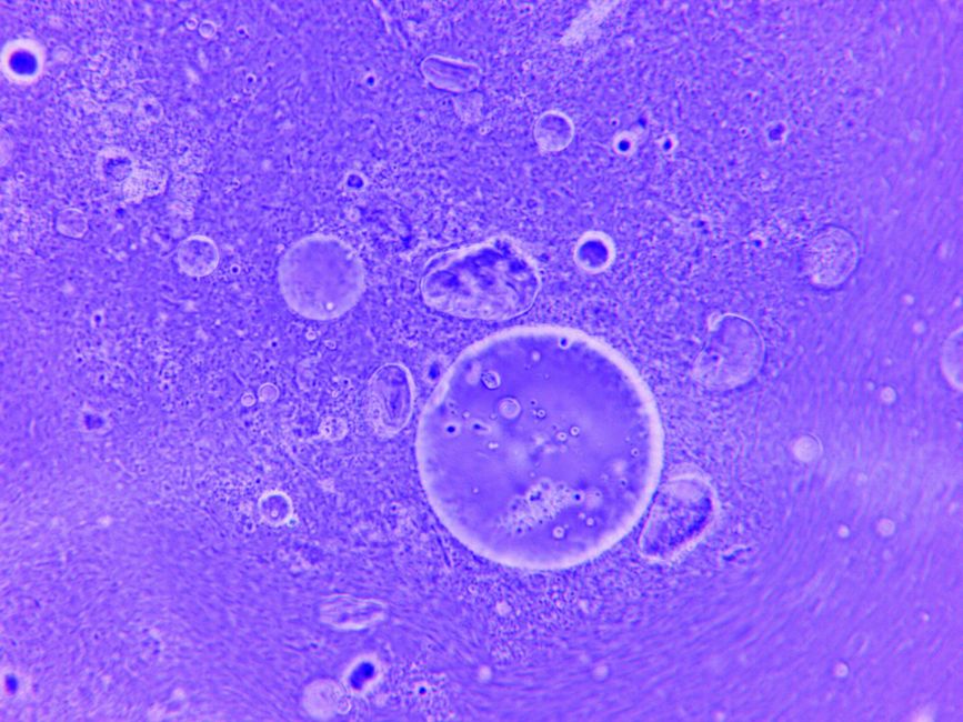 Blue abstract image of water droplets and particles under a microscope.