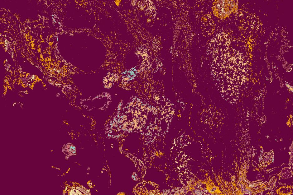 Dynamic marbled abstract art with rich purple and yellow swirls creating a mesmerizing pattern.