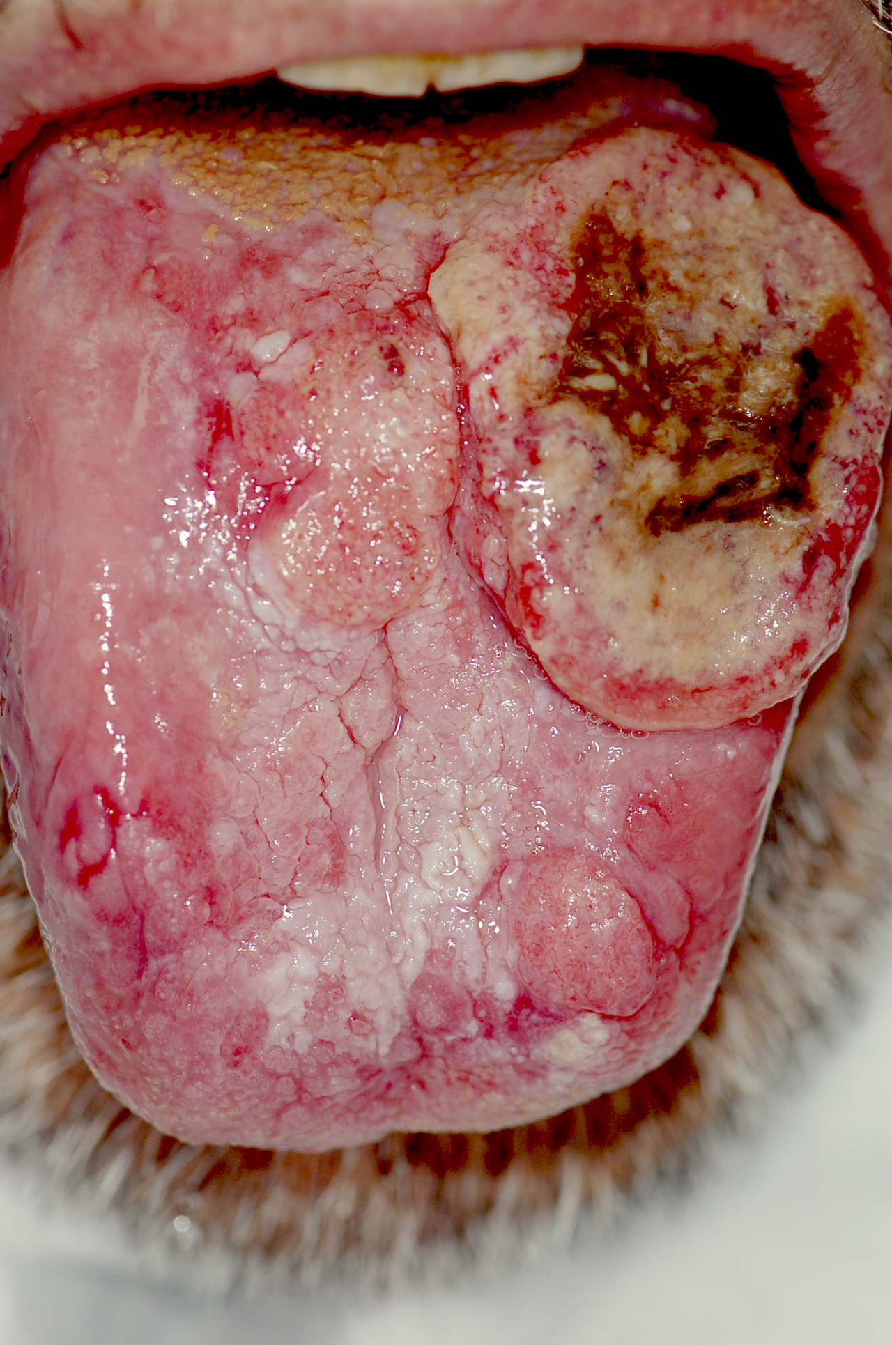 PLoS oral cancer