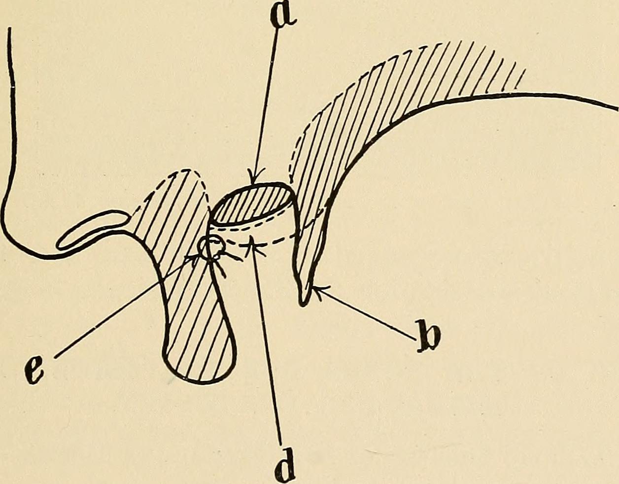 Oral surgery; a text-book on general surgery and medicine as applied to dentistry (1912) (14592940238)
