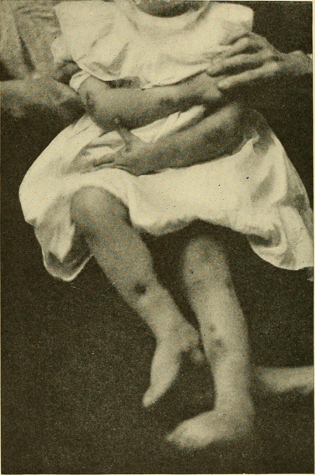 Oral surgery; a text-book on general surgery and medicine as applied to dentistry (1912) (14592778390)
